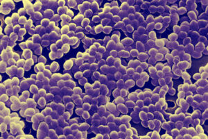 Trinkwasser-Keime Enterokokken